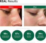 Dr.G Red Blemish Clear Soothing Cream 30ml - Image 2