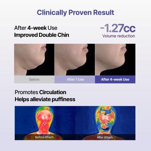 Meditherapy Tension Up Sheet Mask - Image 5