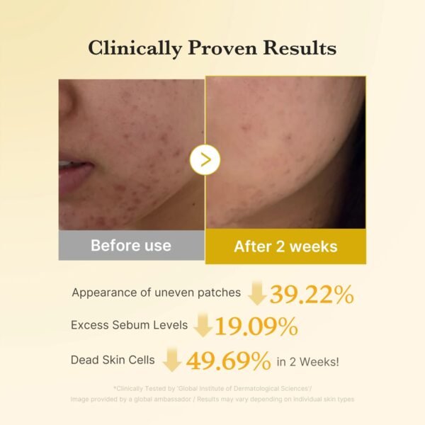 Medicube Kojic Acid Tumeric Toner Pad - Image 3