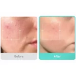 Medicube Azelaic Acid 16 BB Soothing Serum - Image 3