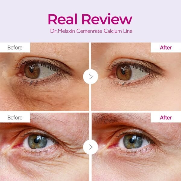 Dr. Melaxin Cemenrete Calcium Volume Eye Patch 60ea | Korean Eye Patches for Fine Lines & Puffy Eyes - Image 2
