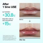 ANUA PDRN Lip Serum - Image 3