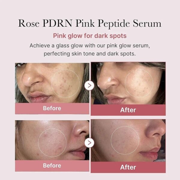 Medicube Ultra Light PDRN Pink Peptide Serum 30mL - Image 2