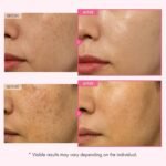 TOSOWOONG Arbutin 7.0 Glutathione Cream - Image 2