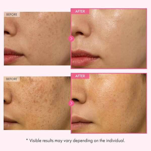 TOSOWOONG Arbutin 7.0 Glutathione Cream - Image 2